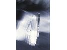 K2 Blur 74 W - ERC 11 TCx Light QuikClik, anthracite | Bild 6