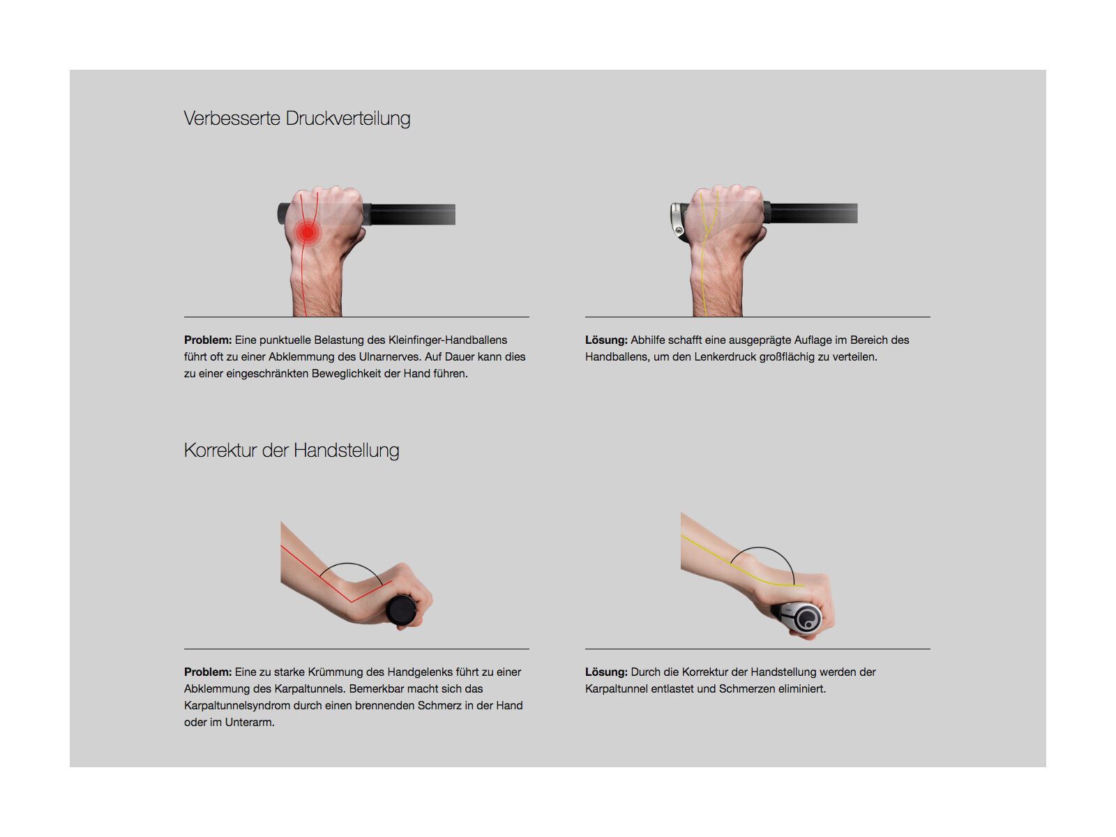 Ergon GS3 Small mit 3-Finger Barend - Bild 3
